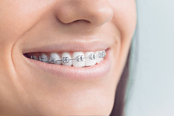 Best Tooth Extraction  in Oregon, WI